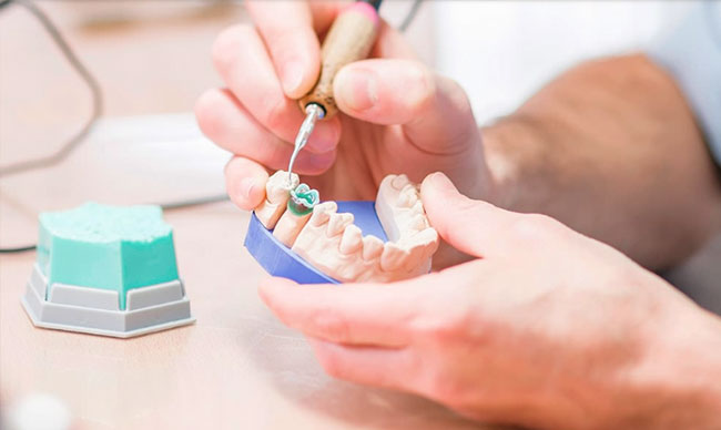 В клинике «КласДент» осуществляются все виды стоматологических услуг, в том числе съемное и несъемное протезирование.